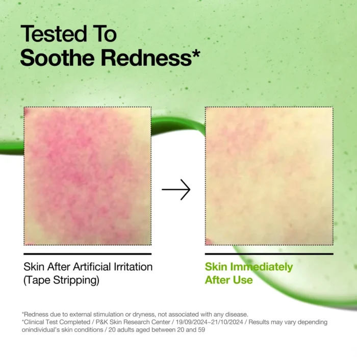 ANUA Azelaic Acid 10 Hyaluron Redness Soothing Serum 30ml - Image 3